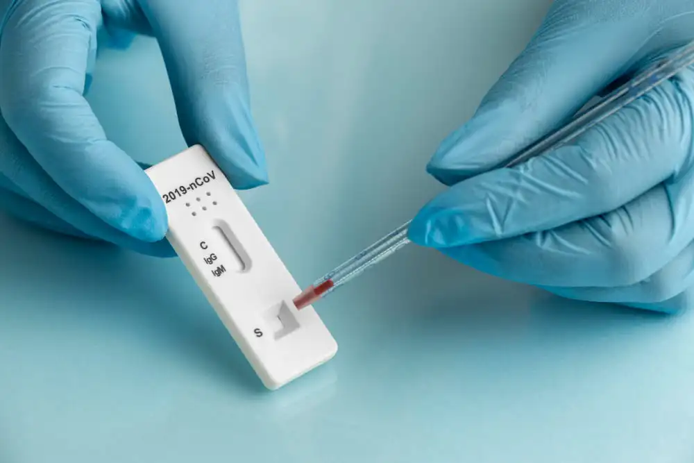 corona-antigen-schnelltest